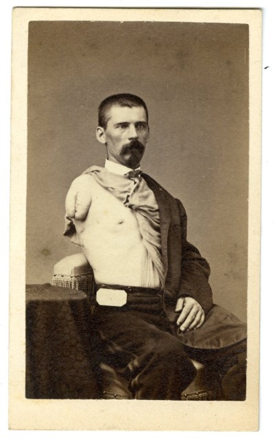 Army Medical Museum-Wounded Soldier CDV